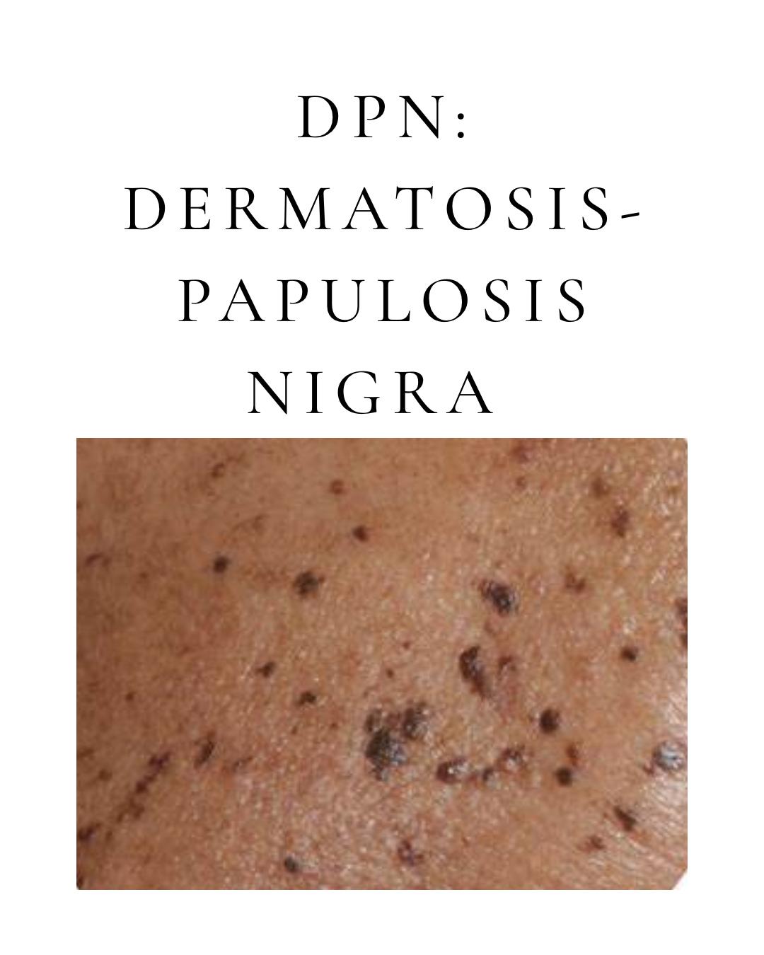 Dermatosa Papulosa Nigra